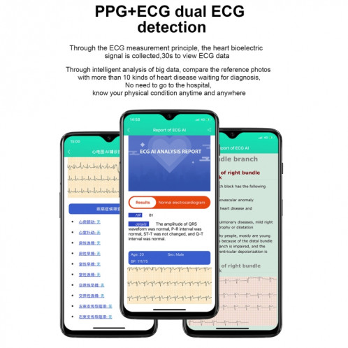 E86 1,7 pouce TFT Color Screen Smart Watch Smart Smart, Support Surveillance de l'oxygène sanguin / Surveillance de la température corporelle / Diagnostic médical Ai, Style: Bracelet en cuir (Noir) SH401A1085-024