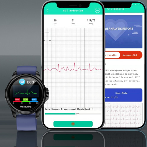 E89 1,32 pouces écran bracelet en cuir montre de santé intelligente prend en charge la fonction ECG, diagnostic médical AI, surveillance de la température corporelle (marron) SH301B1073-07